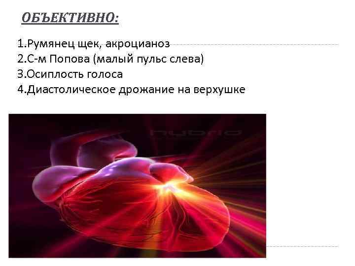 ОБЪЕКТИВНО: 1. Румянец щек, акроцианоз 2. С-м Попова (малый пульс слева) З. Осиплость голоса