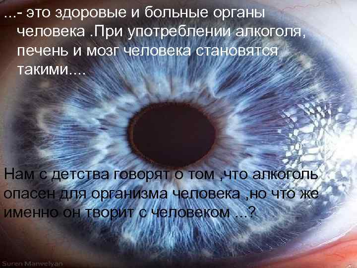 . . . - это здоровые и больные органы человека. При употреблении алкоголя, печень