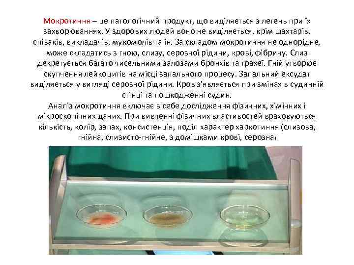 Мокротиння – це патологічний продукт, що виділяється з легень при їх захворюваннях. У здорових