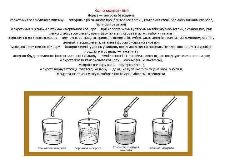 Колір мокротиння Норма — мокрота безбарвна. харкотиння зеленуватого відтінку — говорить про гнійному процесі: