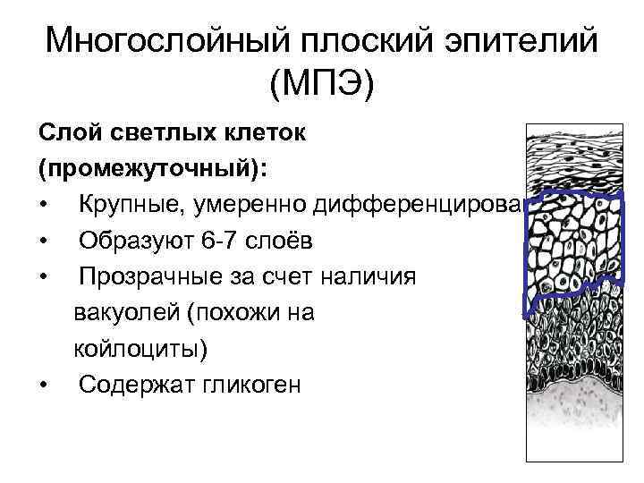 Многослойный плоский эпителий (МПЭ) Слой светлых клеток (промежуточный): • Крупные, умеренно дифференцированные • Образуют