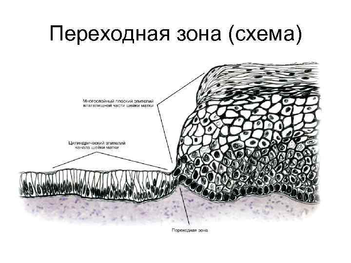 Переходная зона (схема) 