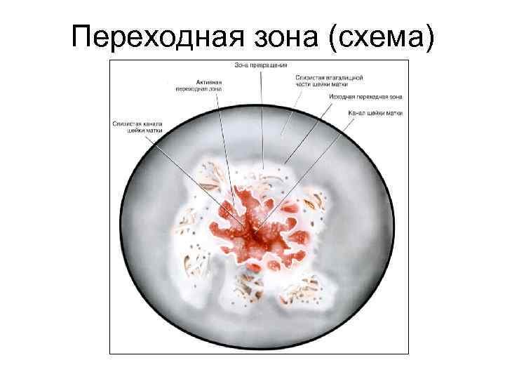 Переходная зона (схема) 