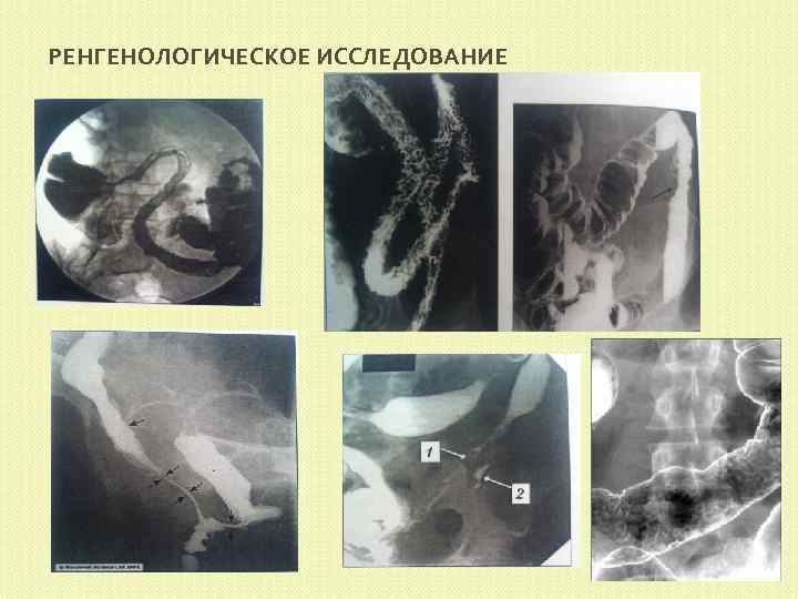 РЕНГЕНОЛОГИЧЕСКОЕ ИССЛЕДОВАНИЕ 
