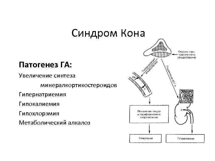 Синдром Кона Патогенез ГА: Увеличение синтеза минералкортикостероидов Гипернатриемия Гипокалиемия Гипохлорэмия Метаболический алкалоз 