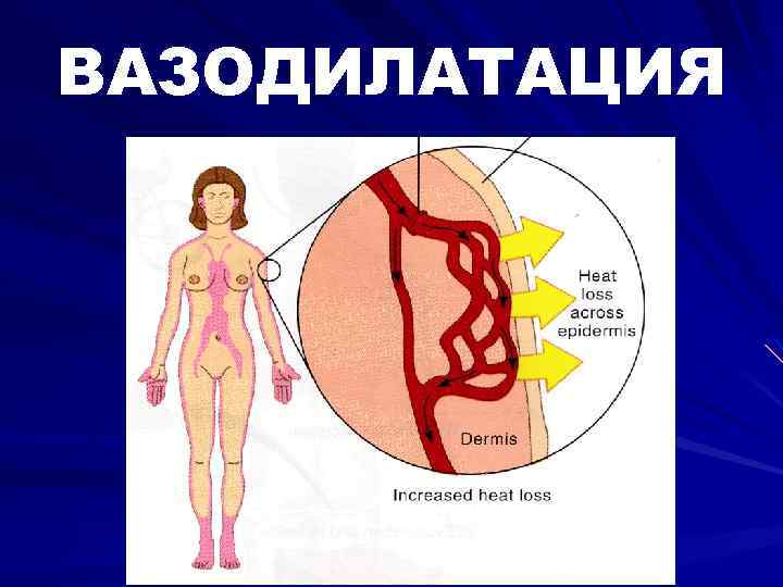 ВАЗОДИЛАТАЦИЯ 