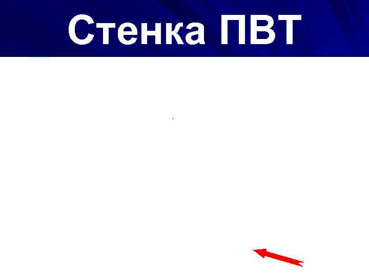 Стенка ПВТ 