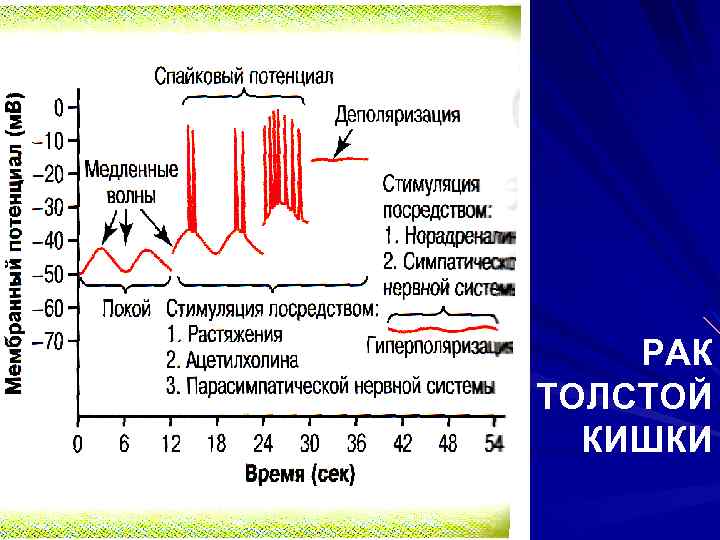 РАК ТОЛСТОЙ КИШКИ 
