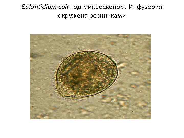 Balantidium coli под микроскопом. Инфузория окружена ресничками 