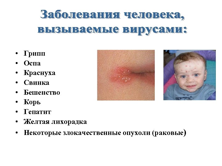  • • • Грипп Оспа Краснуха Свинка Бешенство Корь Гепатит Желтая лихорадка Некоторые