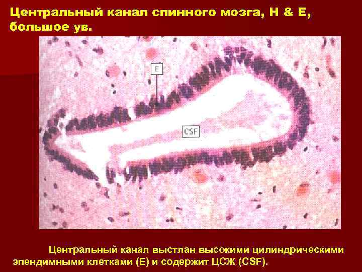 Центральный канал спинного мозга, H & E, большое ув. Центральный канал выстлан высокими цилиндрическими
