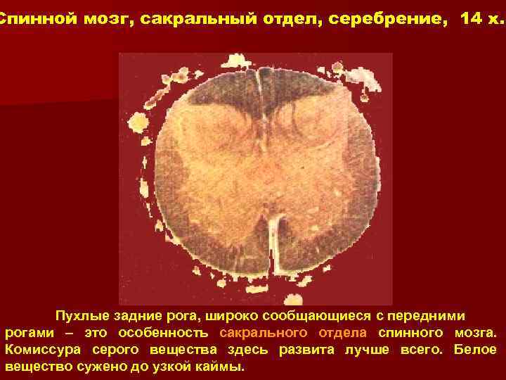 Спинной мозг, сакральный отдел, серебрение, 14 x. Пухлые задние рога, широко сообщающиеся с передними