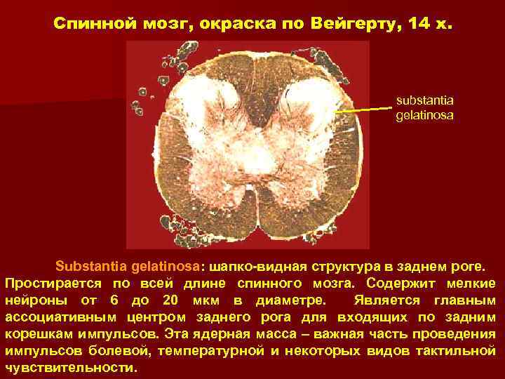 Спинной мозг, окраска по Вейгерту, 14 x. substantia gelatinosa Substantia gelatinosa: шапко-видная структура в
