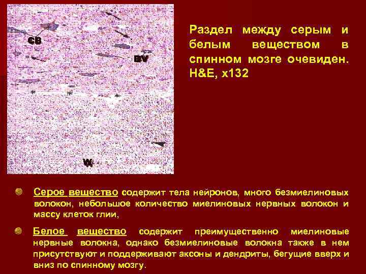 CB BV Раздел между серым и белым веществом в спинном мозге очевиден. H&E, x