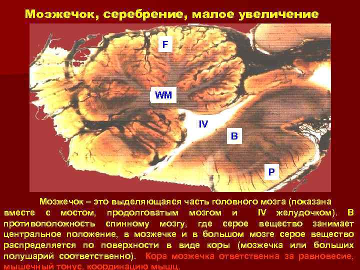 Мозжечок, серебрение, малое увеличение F WM IV B P Мозжечок – это выделяющаяся часть