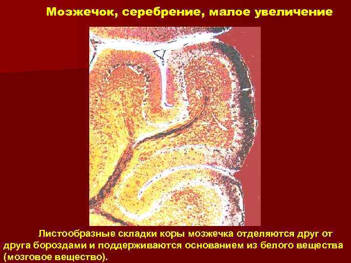 Мозжечок, серебрение, малое увеличение Листообразные складки коры мозжечка отделяются друг от друга бороздами и