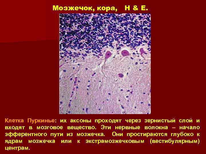 Мозжечок, кора, H & E. Клетка Пуркинье: их аксоны проходят через зернистый слой и