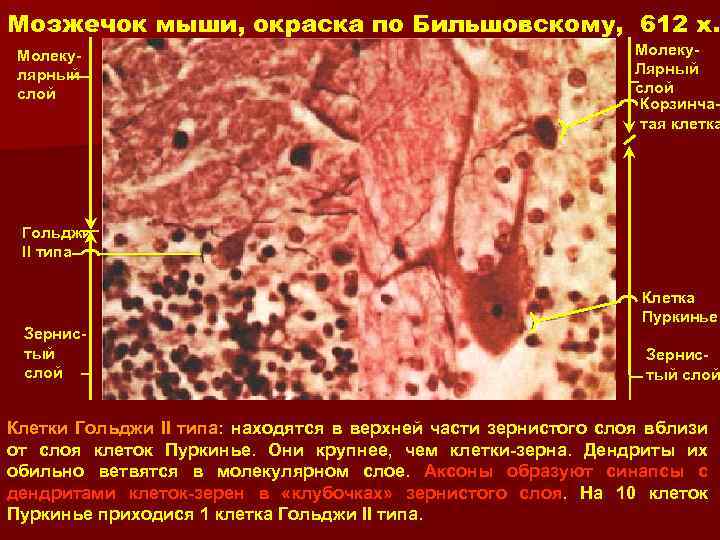 Мозжечок мыши, окраска по Бильшовскому, 612 x. Молекулярный слой Молеку. Лярный слой Корзинчатая клетка