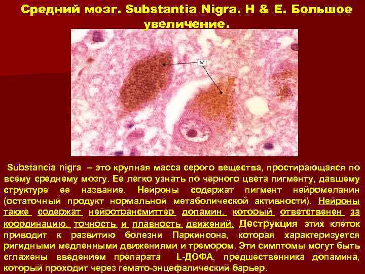 Средний мозг. Substantia Nigra. H & E. Большое увеличение. Substancia nigra – это крупная