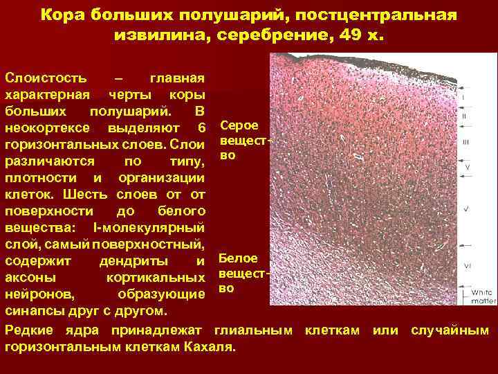Кора больших полушарий, постцентральная извилина, серебрение, 49 x. Слоистость – главная характерная черты коры