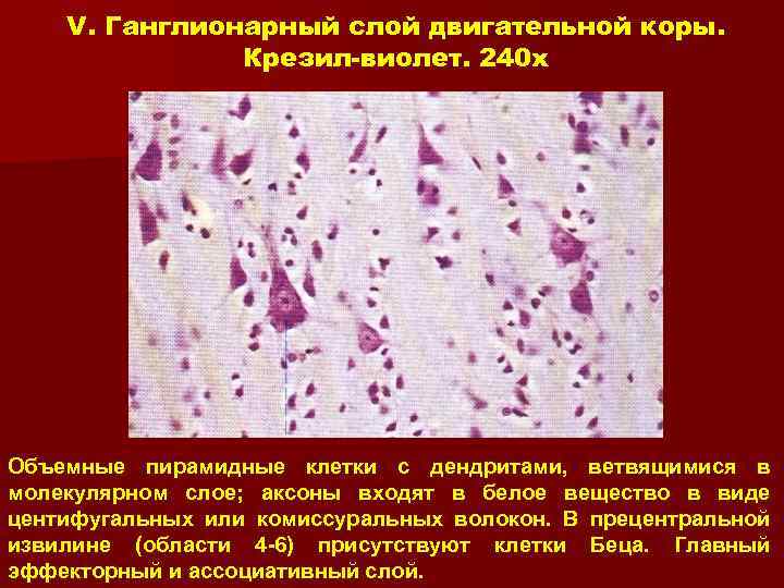 V. Ганглионарный слой двигательной коры. Крезил-виолет. 240 x Объемные пирамидные клетки с дендритами, ветвящимися