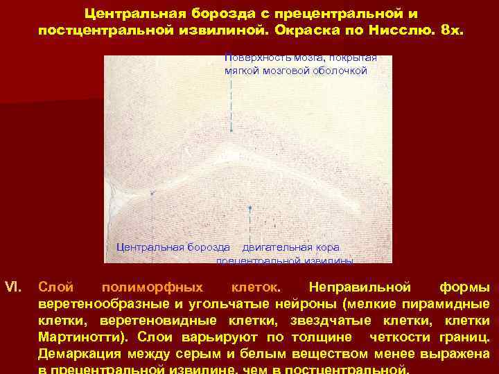 Центральная борозда с прецентральной и постцентральной извилиной. Окраска по Нисслю. 8 x. Поверхность мозга,