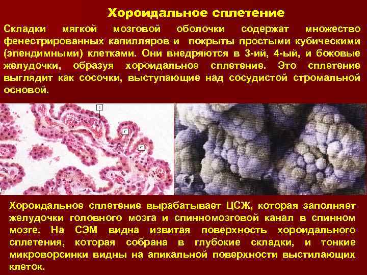 Хороидальное сплетение Складки мягкой мозговой оболочки содержат множество фенестрированных капилляров и покрыты простыми кубическими