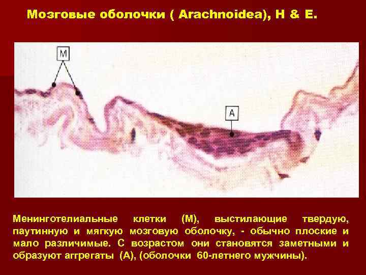 Мозговые оболочки ( Arachnoidea), H & E. Менинготелиальные клетки (М), выстилающие твердую, паутинную и