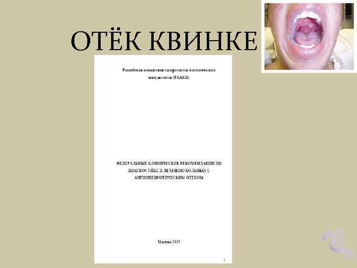 ОТЁК КВИНКЕ 