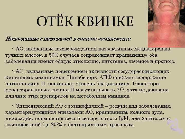 ОТЁК КВИНКЕ Несвязанные с патологией в системе комплемента • АО, вызванные высвобождением вазоактивных медиаторов