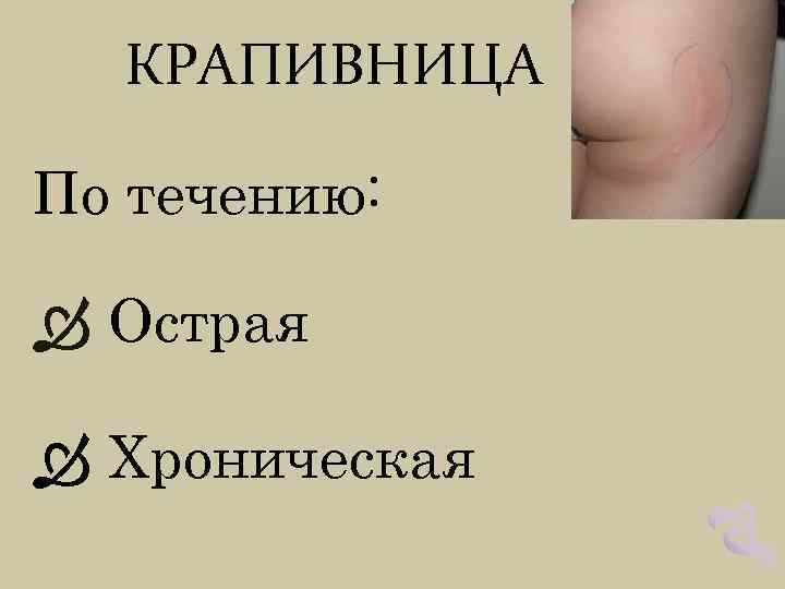 КРАПИВНИЦА По течению: Острая Хроническая 