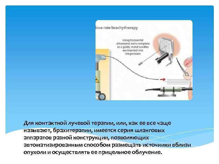 Для контактной лучевой терапии, или, как ее все чаще называют, брахитерапии, имеется серия шланговых
