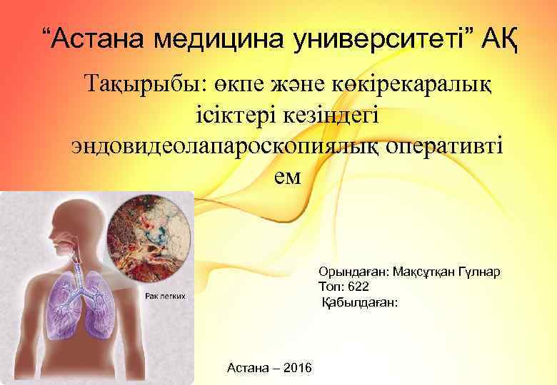 “Астана медицина университеті” АҚ Тақырыбы: өкпе және көкірекаралық ісіктері кезіндегі эндовидеолапароскопиялық оперативті ем Орындаған:
