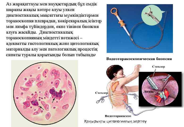 Аз жарақаттауы мен науқастардың бұл емдік шараны жақсы көтере алуы улкен диагностикалық мақсаттағы мүмкіндіктермен