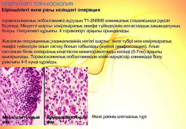 ОПЕРАТИВТІ ТОРАКОСКОПИЯ Біріншілікті өкпе рагы кезіндегі операция торакоскопиялық лобэктомияға аурудың T 1 -2 N