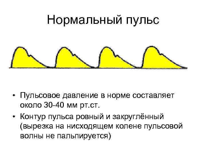 Нормальный пульс • Пульсовое давление в норме составляет около 30 40 мм рт. ст.