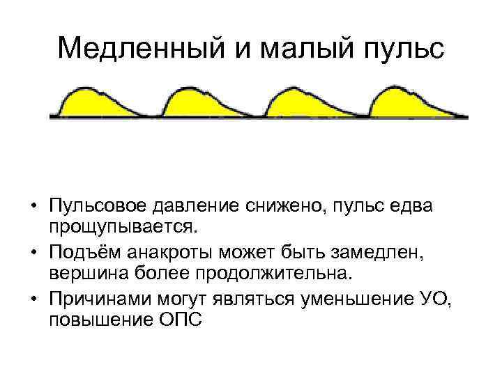 Медленный и малый пульс • Пульсовое давление снижено, пульс едва прощупывается. • Подъём анакроты