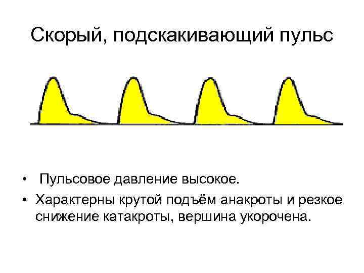 Скорый, подскакивающий пульс • Пульсовое давление высокое. • Характерны крутой подъём анакроты и резкое