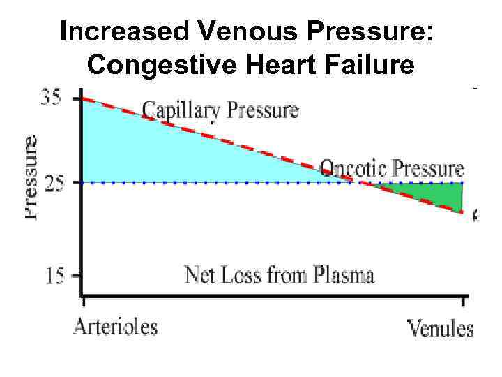 Increased Venous Pressure: Congestive Heart Failure 