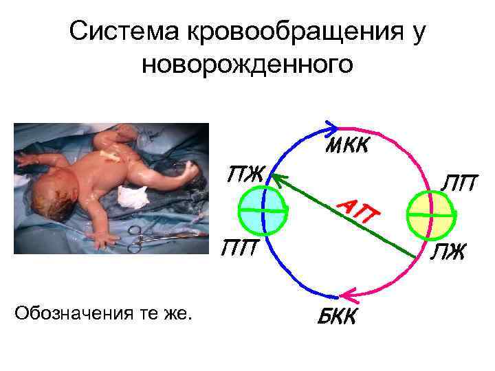 Система кровообращения у новорожденного Обозначения те же. 