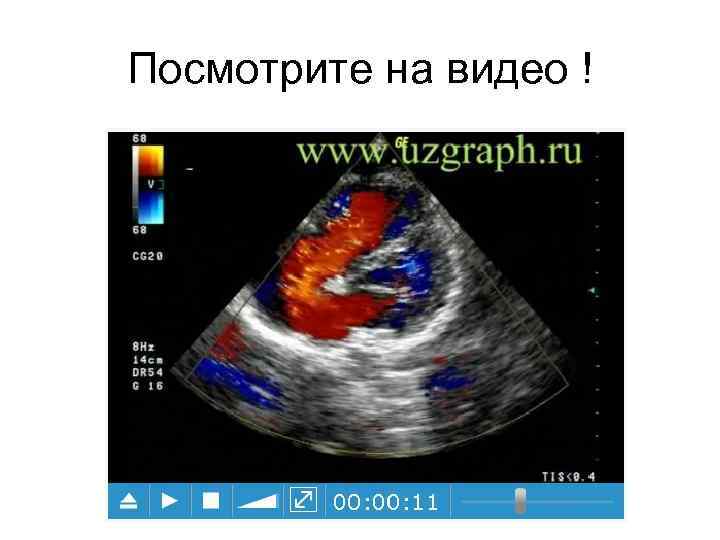 Посмотрите на видео ! 