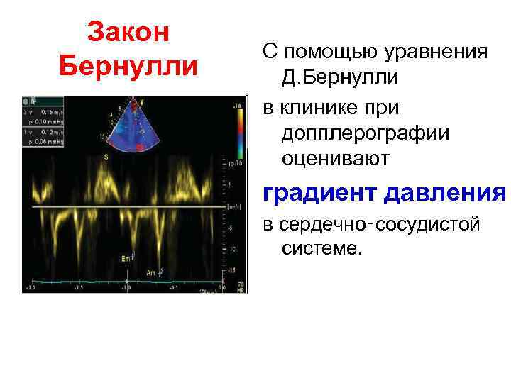 Закон Бернулли С помощью уравнения Д. Бернулли в клинике при допплерографии оценивают градиент давления