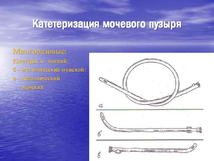 Катетеризация мочевого пузыря Многоразовые: Катетеры: а – мягкий; б – металлический мужской; в –