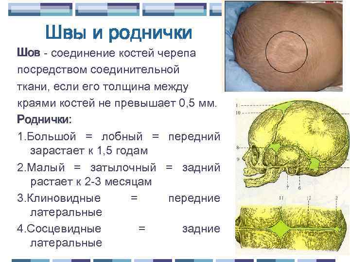 Швы и роднички Шов - соединение костей черепа посредством соединительной ткани, если его толщина