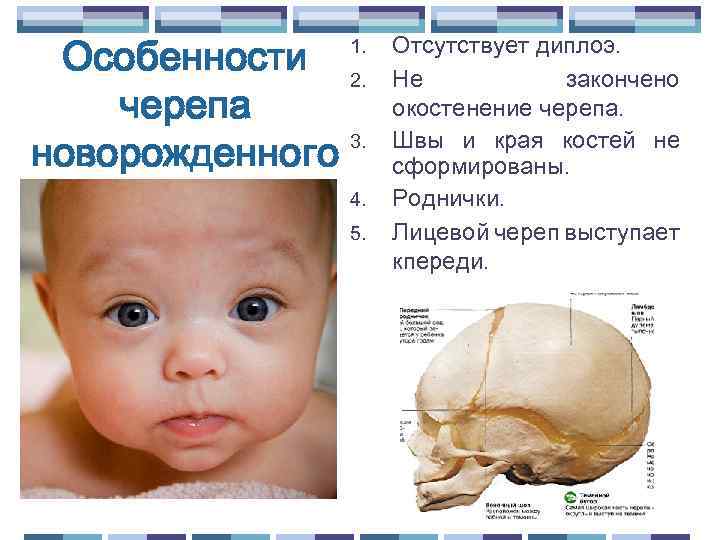 Особенности 2. черепа 3. новорожденного 1. 4. 5. Отсутствует диплоэ. Не закончено окостенение черепа.