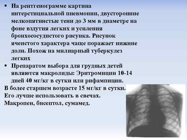 Легочный рисунок усилен за счет сосудистого компонента. Усиление бронхососудистого рисунка. Ячеистое усиление легочного рисунка. Ячеистый характер легочного рисунка.