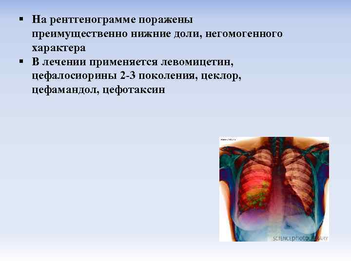 § На рентгенограмме поражены преимущественно нижние доли, негомогенного характера § В лечении применяется левомицетин,