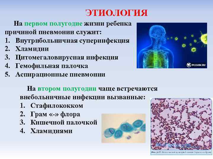 ЭТИОЛОГИЯ На первом полугодие жизни ребенка причиной пневмонии служит: 1. Внутрибольничная суперинфекция 2. Хламидии