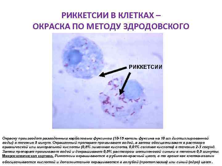 РИККЕТСИИ В КЛЕТКАХ – ОКРАСКА ПО МЕТОДУ ЗДРОДОВСКОГО РИККЕТСИИ Окраску производят разведенным карболовым фуксином