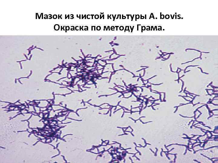 Мазок из чистой культуры A. bovis. Окраска по методу Грама. 